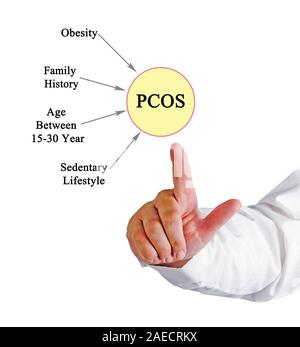 Sindrome ovarica policistica Foto Stock