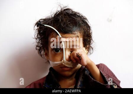 Pechino, Yemen. 1 apr, 2019. Un bambino malnutriti si siede sul letto come egli riceve un trattamento medico a una malnutrizione care Center in Sanaa, Yemen, il 1 aprile 2019. Credito: Mohammed Mohammed/Xinhua/Alamy Live News Foto Stock