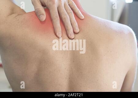 L'uomo tiene per mano per il rossore nella zona delle spalle e del collo. L'uomo hanno dolore al collo, dolore alla spalla Foto Stock