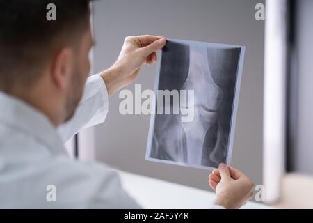 Close-up di un medico di sesso maschile di mano azienda ginocchio X-ray Foto Stock
