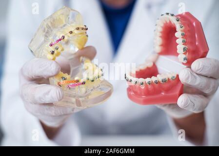 Il medico mostra come il sistema di bretelle sui denti è disposto Foto Stock