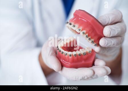 Il medico mostra come il sistema di bretelle sui denti è disposto Foto Stock