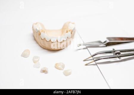 Intonaco artificiale modello ganascia con impiallacciatura e strumenti odontoiatrici sullo sfondo bianco. Concetto di odontoiatria estetica e tecnologia di impianto Foto Stock