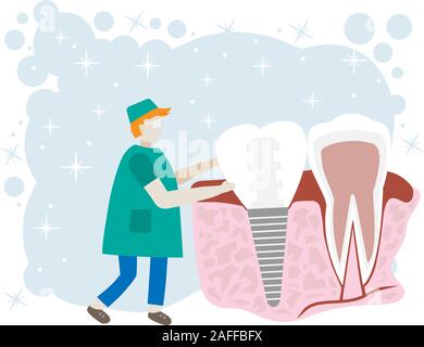 Impianto dentale. Dentista tenendo in mano di dentiere. Attrezzature mediche. Dente trattamento. Illustrazione Vettoriale design piatto. Stomatologia sullo sfondo. Illustrazione Vettoriale