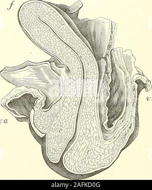 . La diagnosi di una patologia e il trattamento delle malattie delle donne compresa la diagnosi di gravidanza. h sono già state par-ticularly descritto (vedere Infiammazione cronica dell'utero).ipertrofia, il risultato di una infiammazione cronica e difettoso in-Rivoluzione, uno o entrambi, è più palpabilmente evidente nel cervicalregion, come questo può essere raggiunto facilmente e ispezionati, ma è rarelylimited a questa porzione. Ipertrofia dell'utero è particolarmente suscettibili di verificarsi in associ-zione con la crescita di tumori fibroidi entro le pareti dell'organo. 31 482 patologia e trattamento. Un tumore fibroide del uteru Foto Stock