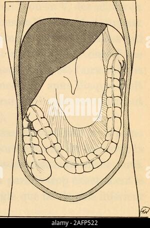 . Anatomie médico-chirurgicale de l'addome. B Foto Stock