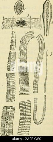 . Medicina interna; un lavoro per il medico sulla diagnosi e trattamento, con una scrivania completa indice. ochondria. Con-vulsions, Huntington, vertiginose attacchi, oftenattributed al parassita, sono raramente directlycaused da esso. La cessazione di qualsiasi gruppo ofsymptoms dopo la sua rimozione è importante.autosuggestione è quello di essere considerato. In altre mani sintomi fastidiosi a volte sono indubbiamente dovute tointestinal irritazione o a sostanze tossiche, si è evoluta dal worm, actingupon il sistema nervoso e il sangue-hiemoly.sis. Il Bothriocephalusmay essere la causa di una grave anemia avente la ch Foto Stock