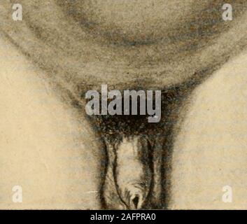 . Anatomie médico-chirurgicale de l'addome. Foto Stock