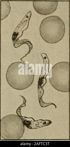 . La diagnosi medica per lo studente e professionista. Fig. 5 74. - Strongy-loides intestinalis. (A)femminile, (b) rhabditiformlarva, (c) larva filiformi.{Dopo Br ami.). Fig. 575.-Trypa-nosoma gambiensis.{Dutton e Laveran). Foto Stock