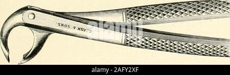 . La scienza e la pratica della chirurgia dentaria. ed prima. La ganascia deveessere strenuamente sostenuto e'Extractive 651 forza applicata premendo il gomito. Theblades deve essere mantenuto premuto verso il basso tempo di tuttele. Come la radice è conica, la rotazione può essere impiegata come un coadiuvante forceby estrattiva impartire una leggera rotazione indietro per thehandles come essi sono portati verso il basso. Molari inferiori (prima e seconda).-^Thehawks-bill-molari forcipi (vedere Fig. 894) sono thosegenerally consigliata. Le lame sono fatturati, conuna scanalatura su entrambi i lati del becco ; il groovesbeing di pari dimensioni una coppia sufficiente per entrambi s Foto Stock