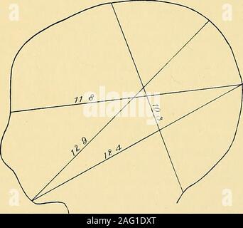 . Manuale di assistenza prenatale patologia e igiene : il feto. nes che compongono il vault,dell'fcetal cranio sono vagamente unite insieme dalla membrana al thCsutures e fontanelle ; ogni studente di ostetricia conosce la suturesand fontanelle, per essi sono le parti che devono essere sentiti duranteil progressi del lavoro. Si presume che il lettore, troppo, è wellacquainted con loro. La base del cranio è costituito da thebasiocciput, il sphenoid, la sinusite etmoide, e petrose-temporals;queste ossa, a differenza di quelli del vault, non modificare la loro posizione relativa come il risultato di pressione portato Foto Stock