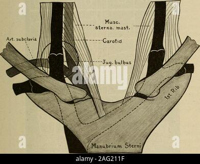 . La diagnosi medica per lo studente e professionista. -L'uso :: fividas nella misura fino a la polygram.E St: :nd passo. Il POLIGRAFO E POLYGRAM 503 dei due, la pulsazione venosa è infinitamente più prezioso in stru-mentale letture. Uno più facilmente riconosce la ex con la sua spinta; quest'ultimo, dal suo crollo. Il sistema venoso impulso quando il normale e visibile sopra o vicino al jugularfossa sembra essere un fantoccio a doppia onda; il primo elemento (un'onda Presystolic * *3, W8. VC della polygram) è presystolic come temporizzato dal cuore di suoni o di apex-beatand il suo crollo precede immediatamente la com Foto Stock