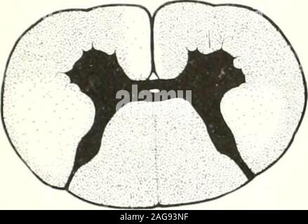 . Un atlante della diagnosi differenziale delle malattie del sistema nervoso (con un fisiologico introduzione); analitico e neurologici semeiological grafici. 8gi, .894, 912, 979, 988, io&lt;T4. 1015, 1172. 1186, 1217 andI-31. Vedere 525. 547-8, 670, 605. 800 iiml 1150 Foto Stock