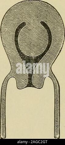 . Essentials di ginecologia, disposti in forma di domande e risposte preparate appositamente per gli studenti di medicina ... Inversione parziale di utero(dopo Thomas). Polipo ancora intra-uterine(dopo Thomas). Sion. Ampliamento dell'utero piuttosto favorisce la diagnosi ofpolypus.Entrambe queste condizioni raramente possono coesistere. In che modo è possibile differenziare inversione dell'utero prolasso fromcomplete ? Questo raramente provoca difficoltà. Esso è fatto di trovare in quest'ultimo 196 Essentials di OYNjECOLOOY. Il sistema operativo esterno. Il obhteration dei fornici. e b ])assing thesound nel canale uterino. Wha Foto Stock