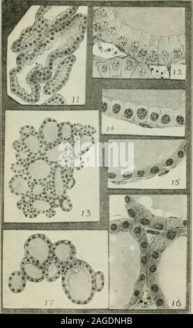 . Endocrinologia. PLATE II figura 11. Rigenerato che mostra la tiroide iperplasia. La figura 12. Elevata potenza di disegno tlie stesso. La figura 13. Gruppo di follicoli da normale (tiroide stessa magnifica-zione come Fig. 11). Le figure 14 e 15. Epitelio della tiroide normale mostra limiti ofvariation in altezza delle celle. La figura 16. Epitelio della tiroide rigenerato in cui vi è stata nohyperplasia. La figura 17. I follicoli della tiroide di piccole dimensioni senza iperplasia (largestsection del premistoppa).. Piastra IIIFigure 18. Epitelio dalla tiroide di rana precoce.La Figura 19. Più grande sezione sagittale della tiroide di precociou Foto Stock