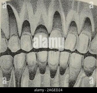 . L'anatomia, la fisiologia e la patologia dei denti umani : con la maggior parte dei metodi approvati di trattamento comprendente le operazioni e il metodo di fabbricazione e l'impostazione dei denti artificiali. Foto Stock