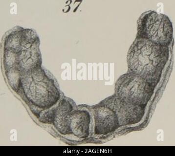 . L'anatomia, la fisiologia e la patologia dei denti umani : con la maggior parte dei metodi approvati di trattamento comprendente le operazioni e il metodo di fabbricazione e l'impostazione dei denti artificiali. Foto Stock