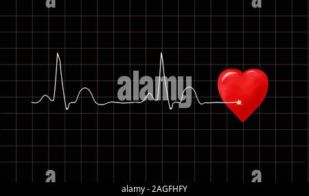 Grafico di ECG Foto Stock