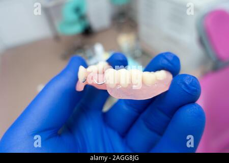 Protesi rimovibile nelle mani di un medico in guanti blu Foto Stock