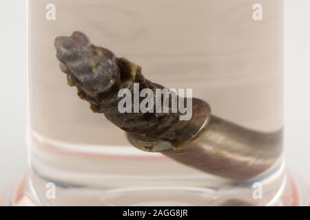 Impianto dentale rimosso dall'osso mandibolare close up Foto Stock