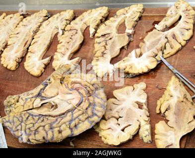 13 dicembre 2019, Sassonia, Lipsia: In una sala di dissezione presso l'Istituto di Anatomia della Facoltà di Medicina dell'Università di Lipsia, immagini di sezione del cervello umano sono visualizzati. In un seminario sulla neuroanatomia, variazioni patologiche del cervello nella malattia di Alzheimer può essere identificato, tra le altre cose. Il centro di formazione per attualmente circa 3000 studenti di medicina umana e dentaria con i suoi 48 istituti e ambulatori è il leader in Germania in termini di breve durata degli studi e il tasso di successo in stato di esame. Foto: Waltraud Grubitzsch/dpa-Zentralbild/ZB Foto Stock