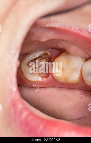 Guarnizione Condensatore Vasca Plastica J00221553 - - IT - Foto 4