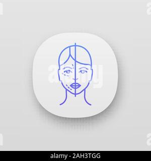 Prima e dopo l'iniezione di neurotossina icona app. Procedura di personalizzazione. Ringiovanimento del viso. La medicina estetica. La cosmetologia. UI/UX interfaccia utente. Web o Illustrazione Vettoriale