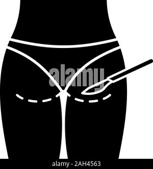 Glifo Gluteoplasty icona. Simbolo di Silhouette. Aumento del gluteo e liposuzione. Sollevamento del gluteo chirurgia. Chirurgia plastica. Lo spazio negativo. Isolat di vettore Illustrazione Vettoriale