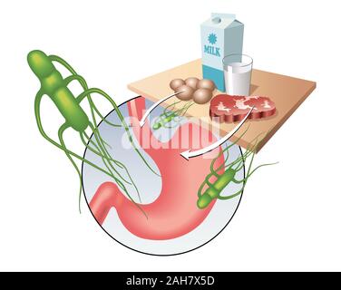 Medical illustrazione che mostra il virus di salmonella e i principali alimenti contaminati. Foto Stock