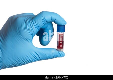 Il tecnico può contenere piccole tubo di sangue in preparazione per il test. Foto Stock