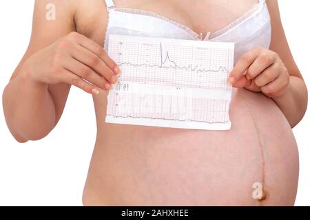 Donna incinta azienda ctg grafico in mano su sfondo bianco. In attesa baby concetto. Foto Stock