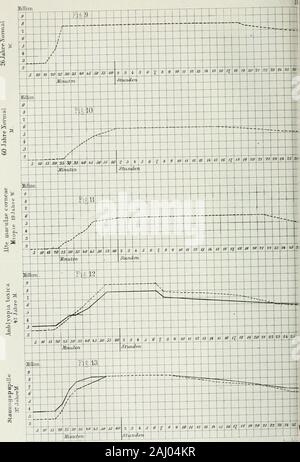 Archivi di oftalmologia e otology . ? T- .... 6 / 5 / ^ 4 / 3 2 s iO è W 15 30 35 w è JO 55 60 2 3 * 5 e ^ 8 0 A II n /3 /? È 16 n è 19 iO 2/ 22 23 2" 25 26 ^r zs 2? Mir Mt •,n St 171 le? Ml] lim. n ^.e 9 8 y - - - -- 1- -- . . L  - -- i -- -- -- - - k-   - - - A - &gt;-- . . " 1 1 - ?-.-? ^, ,  L 6 I -1  • - - - 5 1 * / 3 2 J 10 è 20 25 30 35 4^7 *s così 55 60 2 3 4 5 6 t 8 9 iO M. " " Ik è 16 /8 /9 "" ?21 2" 23 2*. 25 2" n. 2S 25H Mii lU/ en Stl im m a]-erba cipollina Ojlitli. Zlo ^ uncum UM. " M 3S 36 3Z M 39 M */ 42 43 44 45 ke 4f "" 49 50 si ( ) e n   .  .-. ? -- -- R --  .   .   ? Foto Stock