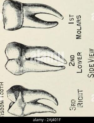 Un atlante delle estrazioni dentali con note sulle cause e sollievo del dolore dentale: progettato per l'uso di medici praticanti e studenti . o c-1. Foto Stock