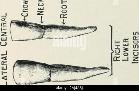 Un atlante delle estrazioni dentali con note sulle cause e sollievo del dolore dentale: progettato per l'uso di medici praticanti e studenti . o3 Foto Stock