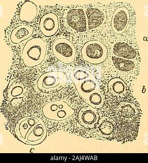 Clinica i principi e la pratica della medicina . Fig 350.. Foto Stock