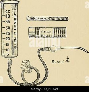 Il post-trattamento delle operazioni; un manuale per professionisti e casa chirurghi . e per ottenere un vetro ordinario cannula in loro. Introdurre la cannula. - Un bendaggio deve prima betied intorno alla parte superiore del braccio per rendere le vene prominenti;poi, qualsiasi vena grande beingchosen (questo sarà usuallybe la mediana basilica), anincision è realizzato al di sopra di itand vena esposta. Loop Adouble di seta o cat-gut viene poi passato beneaththe vena con un aneurismneedle e il thread isdivided in modo che vi sia adouble legatura thevein rotondo. La parte inferiore del theseligatures è poi legato upso come per spegnere il veinbelow; l'ot Foto Stock