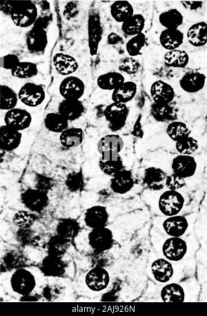 Una visione meccanicistica della guerra e della pace . 5" &lt;?^^M^ V ? La sezione di cervelletto di un soldato che aveva sofferto la fame, la sete e la perdita del sonno ;aveva realizzato la straordinaria marcia forzata di i8o miglia da Mons a Marne;in mezzo alla più grande battaglia nel suo-.ory è stato ferito dalla esplosione di ashell; lay per ore in attesa di aiuto e di^ni da esaurimento subito dopo reachingthe ambulanza. Confrontare la sbiadita-out esaurito le cellule di Purkinje, indicato byarrows, con le cellule di Purkinje in una, anche indicato dalle frecce. La sezione normale della ghiandola surrenale (x 1640) Foto Stock