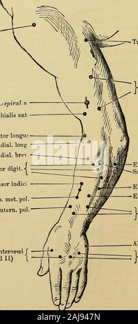 Un manuale di malattie del sistema nervoso . d ha un'azione simile a teres, ma feebler. Esso si contrae quando il armis forzatamente abbassata, e impedisce lo spostamento verso il basso della testa dell'omero per i depressori effettivo, il latissimus e pettorale. Tutti partsextend il gomito a lungo in testa con una forza inferiore rispetto agli altri, ma la sua azione sullato spalla-giunto, appena citato, è impoitant, perché la depressione forzata del braccio theraised è spesso associato con l'estensione del gomito. Nella paralisi del thetriceps, il gomito può essere prorogato solo per il peso dell'avambraccio, ed ex-decine Foto Stock