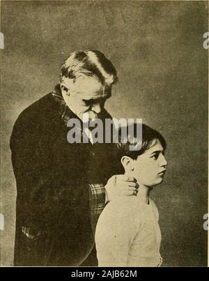 Prima osteopatica aids ai malati : scritto per i malati . aragosta bollita, che di solito inizia sul collo o la guancia e dovrebbe estendersi oltre il corpo theentire in due giorni. Se l'unghia isdrawn oltre il rash, una caratteristica linewill bianco rimangono per un paio di secondi. La linguetta isalso distintivo, essendo rivestito con una pelliccia bianca,bianco con punta rossa e frontiere ed è commonlyknown come la lingua di fragola. Se non vi è la nausea, dolore alla deglutizione, eelevata febbre, ci saranno probabilmente scarlattina ora rash di altro genere; e il paziente dovrebbe figura 13.In generale il trattamento del collo. Con th Foto Stock