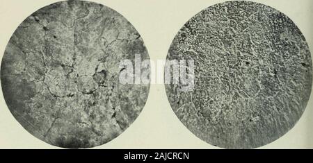 Le transazioni . La microstruttura di acciaio riscaldato a 1150°C, raffreddato lentamente, riscaldato a 680°C e mantenuta a quella temperatura a pochi minuti prima di essere ammessi toCool. (335 diametri.) Fig. 31. Fig. 32.. La microstruttura di acciaio scaldato 2i hrs.a 900° C, raffreddato lentamente, Reheatedto 680° C, e in una volta ammessi toCool. (335 diametri.) microstruttura di acciaio temprato inWater da 680° C. (335 Diam-etri. ) II i iv] DI UEAT-TREA1 uomini l su CR1 CIBL1 - l III. 315 Fio. Foto Stock