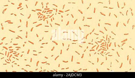 La diagnosi clinica : il batteriologiche, chimiche e microscopiche prova di malattia . hey areknown originario. Ci sono altri micro-organismi che sopportano una notevole somiglianza con thecomma-bacillus. Uno di questi, il bacillo del colera nostras, è un pathogenicmicro-organismo ; un altro è Denekes spirillum di formaggio e un terzo è la Vibriodanubicus di Heider. 2. Il bacillo del colera nostras.- Finhler e prima49 hanno osservato amicro-organismo assimilabile alla virgola-bacillus negli scarichi di choleranostras. Si distingue dal bacillo del colera asiatico principalmente da esso Foto Stock