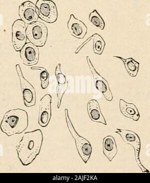 Manuale di patologia : comprese batteriologia, technic di postmortems, e metodi di ricerca patologica . Fig. 460.-cellule del sangue in theUrine, linfa-corpuscoli,i leucociti o Pus-celle, andCrystals di Triple Phos-phate. X 350 diametri.-(Lan-dois.). Foto Stock