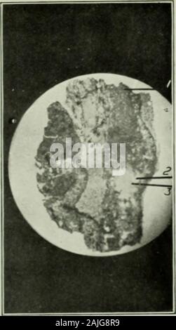 Le transazioni . Ciii: Microi)hotograf&GT;h.s S e 0x7 diarii. 10 E I 1 x ) diaiii. SfTiritr- schi.st.S, Parete Hock, Ilolliri^cr miniera. So. II è lo stesso come No. 10 witli iiicols incrociate. Principalmente Hcricitx-, carbonati e (jimrtz. 12 13. Sorlritc, (ailxuiatcan&lt;I (quarzo &lt; quarzo hnir ( arhoTialc rlioiiilt Foto Stock