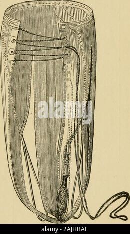 Encyclopaedia - Wikizionario di ostetricia e ginecologia . Fig.  110.-PorLLETs Sericeps. testa. Circa un centinaio di anni fa, idromele, in  Inghilterra, il pensiero del conun panno loop per essere collocato tra il