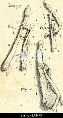 Davidis Cornelii de Courcelles, Med Dott Icones musculorum plantae pedis eorumque descriptio . non funt am-bobus tendinibus comuni , ha jam aeri inci-di curavit Bidlotis Anat. hum. corp. Tak LXVII.& LXVIII.; oriuntura produdione tendinea, e-nata e tendine Subhmis, poft ejus in duas caudasdivifionem, & fine pulpofo quafi, inter articuluniprimum & fecundum digitorum manus terminari.praeterea apparente, Fig. 2. & 3., extremitatestendinum Sublimis & Profundi, ab oilibus, quibusinferebantur , folutae, craifiores & latiores, quamipfae caudae paulo infertionem ante, una parte, quainternodiis affigunt Foto Stock