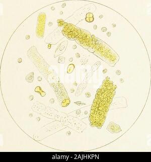 Atlante dei sedimenti urinari; con particolare riferimento al loro significato clinico . Foto Stock