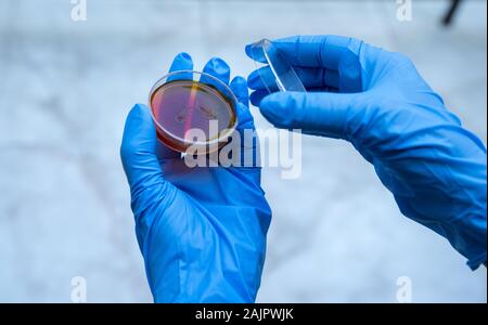 Ricerca batterica. Coltura microbiologica Foto Stock