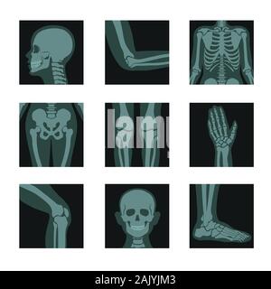 Scheletro e ossa radiografie, testa e mani, gambe e articolazioni Illustrazione Vettoriale