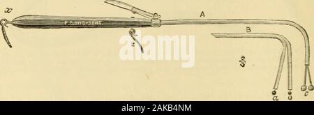 Un manuale di malattie del naso e della gola : compresa la faringe, la laringe, la trachea, l'esofago, naso e rinofaringe . b. La corrente passa quindi lungo il filo, e (che è isolato in caucciù), a sfera themetal,/. In questo modo si completa l'elettrodo n. 1. g rappresenta il capocorda di elettrodo a forma di applicazione lacorrente alla parte posteriore crico-arytenoid muscoli: il manico dello strumento è in legno o in vetro. B thenecklet è che il paziente indossa; ch è la catena da cui il necklet è collegato con il apparatusproducing l'elettricità. La corrente passa attraverso la laringe per la pelle esterna Foto Stock