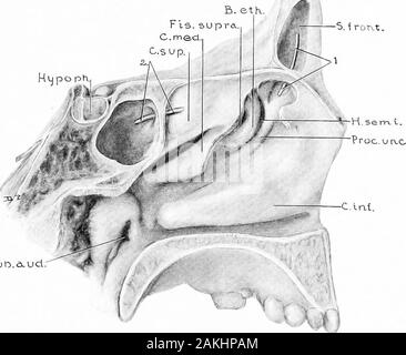 Sviluppo e anatomia dell'accessorio nasale seni nell'uomo; osservazioni basate su duecento novanta laterali pareti nasale, che mostra le varie fasi e i tipi di sviluppo dell'accessorio zone sinusale dal sessantesimo giorno di vita fetale a maturità avanzata . sviluppa sufficientemente per invadere il tratto verticale di osso thefrontal-seni essendo separati da un completeseptum e avente indipendenti di ostia. Sarebbe possibile avere in soprannumero seni de-velop da estensioni dai due cellulse infundibulares, fromtwo cellulse frontales, o da una qualsiasi combinazione di quanto sopra-descrivere Foto Stock